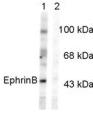 All lanes : Anti-Ephrin B (phospho Y317) antibody (ab33473) at 1/1000 dilutionLane 1 : Rat testes lysate treated with this Ephrin B antibody phosphorylated at Tyr317 (control). Lane 2 : Rat testes lysate incubated in lambda phosphatase (1200 unit for 30 min) before being exposed to this Ephrin B antibody phosphorylated at Tyr317. Lysates/proteins at 50 µg per lane.