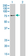All lanes : Anti-EPHX2 antibody (ab67788) at 1/500 dilutionLane 1 : EPHX2 transfected 293T cell lysateLane 2 : Non-transfected 293T cell lysateLysates/proteins at 25 µg per lane.SecondaryGoat Anti-Mouse IgG (H&L)-HRP Conjugate at 1/2500 dilution