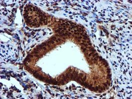 ab119303 at 1/150 dilution staining EPM2AIP1 in Paraffin-embedded Human endometrium tissue by Immunohistochemistry.