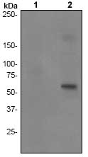 All lanes : Anti-EPO Receptor (phospho Y485) antibody [EPR2266] (ab79824) at 1/50000 dilutionLane 1 : MCF-7 cell lysate untreatedLane 2 : MCF-7 cell lysate treated with pervanadateLysates/proteins at 10 µg per lane.SecondaryGoat anti-rabbit HRP conjugate at 1/2000 dilution
