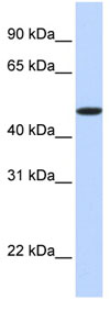 Anti-EPO Receptor antibody (ab83696) at 1 µg/ml (5% skim milk / PBS buffer) + Fetal brain lysate at 10 µgSecondaryHRP conjugated anti-Rabbit IgG at 1/50000 dilution