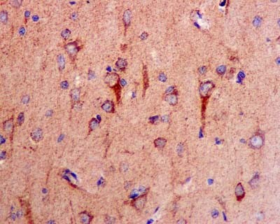 Immunohistochemical analysis of paraffin-embedded Human brain tissue labeling COX5A with ab181226 at 1/250 dilution followed by prediluted HRP Polymer for Rabbit IgG. Counter stained with Hematoxylin.