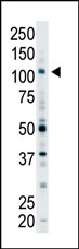 Anti-EPS15R antibody - Aminoterminal end (ab71728) at 1/100 dilution + Y79 cell lysate at 12.5 µg