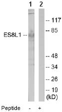 All lanes : Anti-EPS8L1 antibody (ab64839) at 1/500 dilutionLane 1 : Extracts from COLO205 cellsLane 2 : Extracts from COLO205 cells with blocking peptide at 5 µgLysates/proteins at 10 µg per lane.