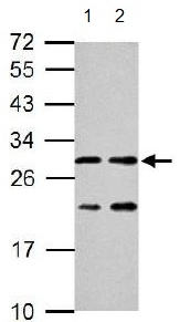All lanes : Anti-ERAB antibody (ab137455) at 1/1000 dilutionLane 1 : Neuro 2A whole cell lysateLane 2 : GL261 whole cell lysateLysates/proteins at 30 µg per lane.