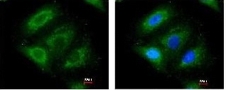 Immunofluorescence analysis of paraformaldehyde fixed A549 cells, labelling ERAB using ab137455 at 1/200 dilution. Right panel costained with Hoerchst 33342.