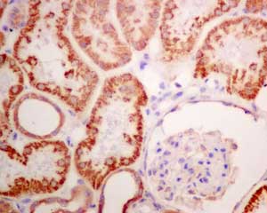 Immunohistochemical analysis of paraffin-embedded Human kidney tissue labeling ERAB with ab167410 at 1/50 dilution.