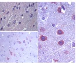 Immunohistochemical analysis of ERAS in paraffin-embedded formalin-fixed rat brain tissue using an isotype control (top, left) and ab72401 (bottom left, and right) at 1:100.