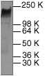 ab2428 at a 1:200 dilution staining SK-BR-3 whole cell lysate.