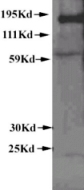 Western blot of whole cell lysates of cultured cells, used at a concentration of 1:1000, incubated overnight at 4C, and visualized with an HRP conjugated secondary, with a chemilumenescent detection method. Review by Todd Gocken submitted 20 July 2004