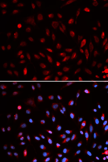 Immunofluorescent analysis of U2OS cells labeling ERCC1 with ab196869 at 1/50. Image at the bottom costained with DAPI.