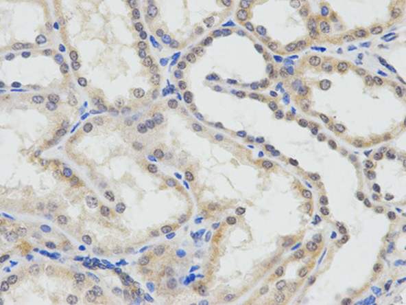 Immunohistochemical analysis of paraffin-embedded Human kidney tissue labeling ERCC1 with ab196869 at 1/50.