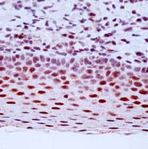 Ab54240 staining human ERCC1 in human tonsil tissue by immunohistochemistry using formalin fixed, paraffin embedded tissue.