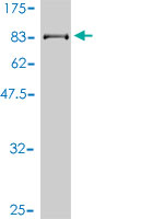 Western blot against tagged recombinant protein immunogen using ab57434 FLJ20105 protein antibody at 1ug/ml.