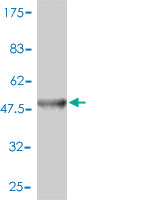 Western blot against tagged recombinant protein immunogen using ab54639 ERCC8 antibody at 1ug/ml.