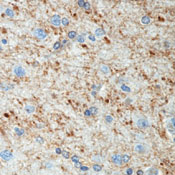 Formalin-fixed, paraffin-embedded human brain stained with ab80789 at 2-4µg/ml using peroxidase-conjugate and DAB chromogen. Note staining of oligodendrocytes and their processes.