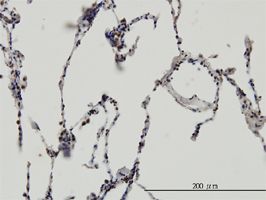 ERH antibody (ab54690) used in immunohistochemistry at 3ug/ml on formalin fixed and paraffin embedded human lung.
