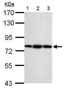 All lanes : Anti-ERp72 antibody (ab155800) at 1/10000 dilutionLane 1 : NIH-3T3 whole cell lysateLane 2 : JC whole cell lysateLane 3 : BCL-1 whole cell lysateLysates/proteins at 30 µg per lane.
