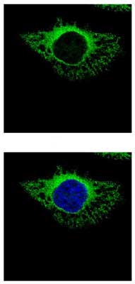 Confocal immunofluorescence analysis of methanol-fixed HeLa cells labeling ERp72 with ab155800 at 1/500 dilution (green). Bottom image shows merger with nuclear staining (blue).