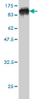 Western blot against tagged recombinant protein immunogen using ab56602 ERp72 antibody at 1ug/ml.