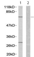 All lanes : Anti-Estrogen Receptor alpha antibody (ab131437) at 1/500 dilutionLane 1 : MCF cell extractLane 2 : MCF cell extract with blocking peptide