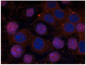 Immunofluorescent analysis of methanol-fixed MCF cells labelling Estrogen Receptor alpha with ab131437 at 1/100 dilution.
