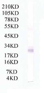 Anti-Coxsackie Adenovirus Receptor antibody (ab167062) at 1/500 dilution + Recombinant Coxsackie Adenovirus Receptor protein