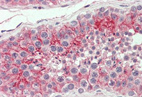 Immunohistochemical analysis of Coxsackie Adenovirus Receptor expression in Formalin-Fixed, Paraffin-Embedded Human testis tissue using 10 µg/ml ab133380.