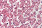 Immunohistochemical analysis of Coxsackie Adenovirus Receptor expression in Formalin-Fixed, Paraffin-Embedded Human liver tissue using 10 µg/ml ab133380.