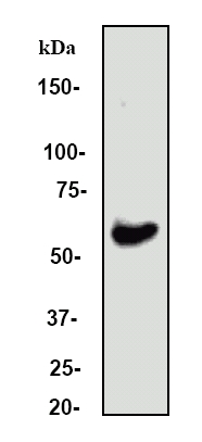 Anti-Estrogen Receptor alpha antibody [E115] - ChIP Grade (ab32063) at 1/500 dilution (unpurified) + MCF-7 cell lysate
