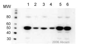 All lanes : Anti-Estrogen Receptor beta antibody (ab3576) at 1/2000 dilutionLane 1 : CAL region of Human brain - Whole cell lysateLane 2 : EC region of Human brain - Whole cell lysateLane 3 : HIP region of Human brain - Whole cell lysateLane 4 : IT region of Human brain - Whole cell lysateLane 5 : MF region of Human brain - Whole cell lysateLane 6 : SP region of Human brain - Whole cell lysateSecondaryHRP conjugated Donkey Anti-rabbit IgG