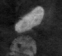 Immunolocalization of ER beta from CHO cells overexpressing the Human protein, using ab3576 (1ug/ml).