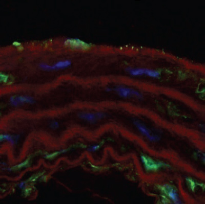Immunofluorescence analysis of frozen murine thoracic aorta, staining Estrogen Receptor beta with ab3576 at 1/50 dilution (green: not merged with nucleus, or purple: merged with nucleus). Nuclei were stained with DAPI (blue) and actin fibers were stained red.
