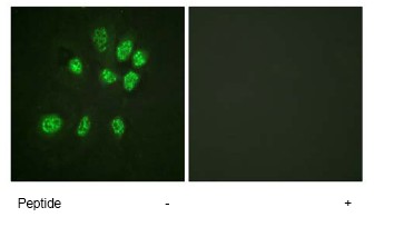 Immunofluorescence analysis of HeLa cells using ab78946 at 1/500 dilution, in the absence or presence of immunising peptide.