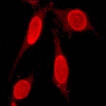 ab92306 at 1/100 dilution staining Estrogen Receptor beta in HeLa cells by immunofluorescence.
