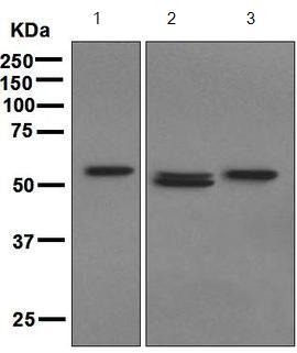 All lanes : Anti-Estrogen Receptor beta antibody [EPR3778] (ab133467) at 1/1000 dilution (unpurified)Lane 1 : MCF7 cell lysateLane 2 : HeLa cell lysateLane 3 : 293T cell lysateLysates/proteins at 10 µg per lane.SecondaryHRP labelled goat anti-rabbit at 1/2000 dilution