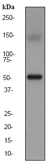 Anti-Estrogen Related Receptor alpha antibody [EPR46Y] (ab76228) at 1/5000 dilution + HeLa cell lysate at 10 µgSecondaryHRP labelled goat anti-rabbit at 1/2000 dilution