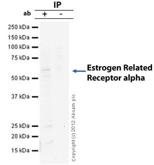 Estrogen Related Receptor alpha was immunoprecipitated using 0.5mg Hela whole cell extract, 10µg of Rabbit monoclonal to Estrogen Related Receptor alpha and 50µl of protein G magnetic beads (+). No antibody was added to the control (-). The antibody was incubated under agitation with Protein G beads for 10min, Hela whole cell extract lysate diluted in RIPA buffer was added to each sample and incubated for a further 10min under agitation.Proteins were eluted by addition of 40µl SDS loading buffer and incubated for 10min at 70oC; 10µl of each sample was separated on a SDS PAGE gel, transferred to a nitrocellulose membrane, blocked with 5% BSA and probed with ab76228.Secondary: Mouse monoclonal [SB62a] Secondary Antibody to Rabbit IgG light chain (HRP) (ab99697).Band: Band: 55kDa: Estrogen Related Receptor alpha.