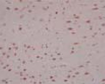 ab41868 staining estrogen related receptor alpha in Rat Cerebrum (1-10 ug/mL) by immunohistochemistry, formalin-fixed paraffin embedded sections.