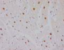 ab41868 staining estrogen related receptor alpha in Human Heart Myocardium (1-10 ug/mL) by immunohistochemistry, formalin-fixed paraffin embedded sections.