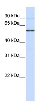 Anti-Estrogen Related Receptor beta antibody (ab104804) at 1 µg/ml + MCF-7 cell lysate at 10 µg