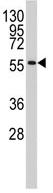 Anti-Estrogen Related Receptor gamma antibody (ab82319) at 1/50 dilution (purified) + 293 cell lysate at 35 µg