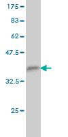 Western blot against tagged recombinant protein immunogen using ab57750 CP2c antibody at 1ug/ml.