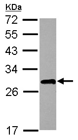 Anti-ETHE1 antibody (ab154041) at 1/1000 dilution + HCT116 whole cell lysate at 30 µg
