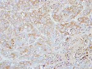 Immunohistochemical analysis of paraffin-embedded Human MCF7 xenograft tissue, labeling ETHE1 with ab154041 at 1/500 dilution.