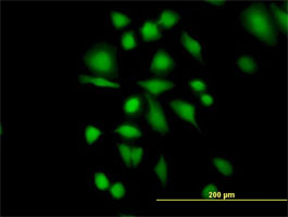 Immunofluorescence analysis of HeLa cells using protein A purified ab76528 at 10 ug/ml