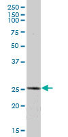 Anti-ETHE1 antibody (ab67528) at 1/500 dilution + human liver lysate at 25 µgSecondaryGoat Anti-Mouse IgG (H&L)-HRP conjugated at 1/2500 dilution