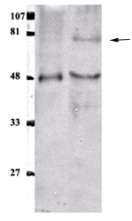All lanes : Anti-ETS1 associated protein II antibody (ab33246) at 1/1000 dilutionLane 1 : 5ug of Purified ETS1 associated protein.Lane 2 : 30 ug of OV2008 human ovarian cancer cell line, whole cell lysate.