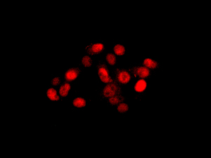 Immunofluorescent staining of HepG2 cells labeling ETS1 associated protein II with ab176341 at 1/100 dilution.