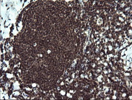 Immunohistochemical analysis of paraffin-embedded Human tonsil tissue labelling ETS2 with ab140371 at 1/150 dilution.